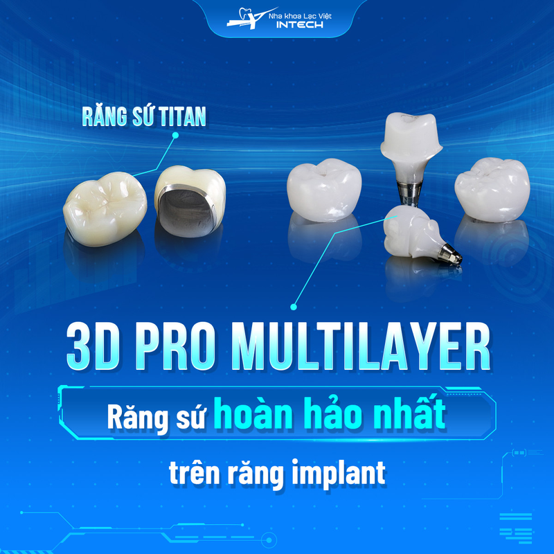 Giá cả của răng sứ phụ thuộc vào chất liệu và công nghệ chế tác, ngoài ra cô chú/anh chị cũng nên cân nhắc đến độ bền của các dòng mão sứ khác nhau