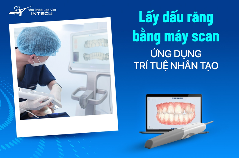 Nha khoa Lạc Việt Intech sử dụng máy scan dấu răng 3D và thiết kế mão răng sứ cá nhân hóa ngay tại chỗ