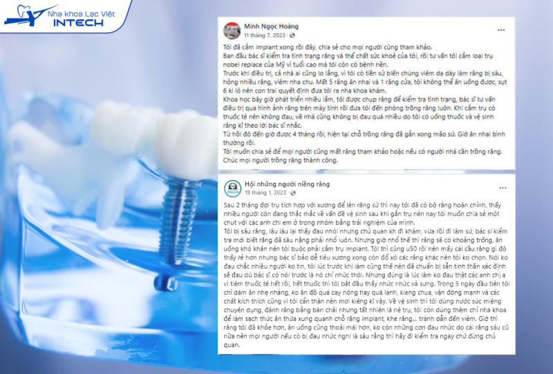 Tùy cơ địa mỗi người, thời gian hoàn tất một trường hợp phục hình Implant thường khoảng từ 2 đến 6 tháng