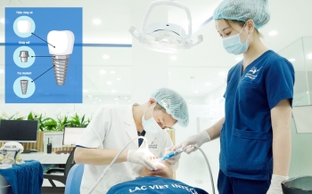 Công nghệ phục hình răng sứ trên implant DCT
