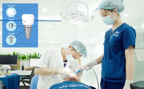 Công nghệ phục hình răng sứ trên implant DCT