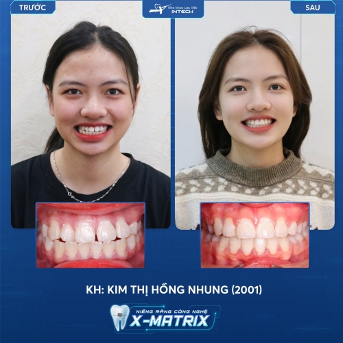 Kim Thị Hồng Nhung