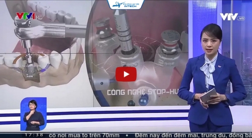 VTV1 đưa tin về công nghệ trồng răng Implant SAFE TECH