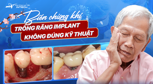 Biến chứng cấy Implant