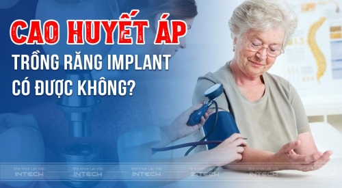 Cao huyết áp trồng răng Implant được không