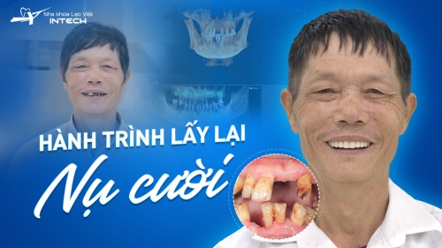 “CÓ HÀM RĂNG MỚI TÔI NHƯ ĐƯỢC SỐNG LẠI”