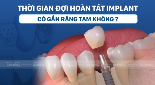 Trong thời gian đợi trồng răng impalnt có gắn răng tạm không