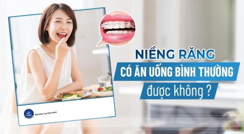 niềng răng có ăn uống bình thường được không