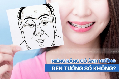 Niềng răng ảnh hưởng tướng số hay không? Giải mã chi tiết