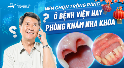Nên chọn trồng răng ở bệnh viện hay phòng khám nha khoa? 