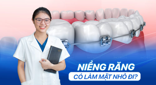 niềng răng có làm mặt nhỏ đi không