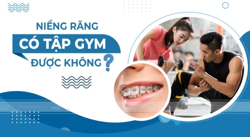 niềng răng có tập gym được không