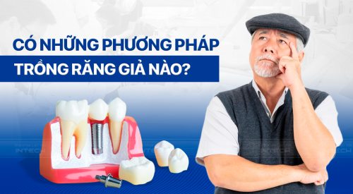 Có những phương pháp trồng răng giả nào? Phương pháp nào tốt nhất?