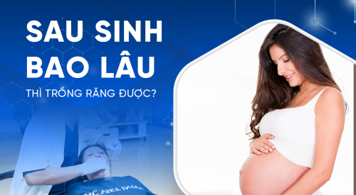 sau sinh bao lâu thì trồng răng được