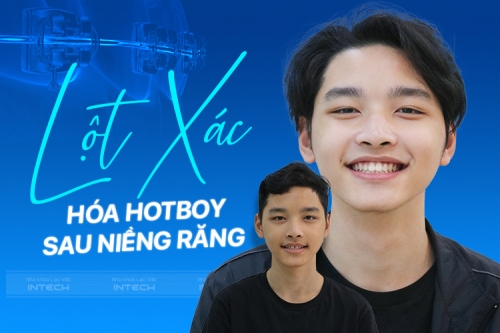 “LỘT XÁC” HÓA HOTBOY NHỜ NIỀNG RĂNG