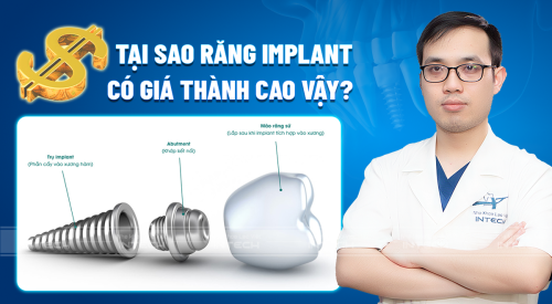 Tại sao răng implant có giá cao vậy? Những yếu tố quyết định giá trồng răng