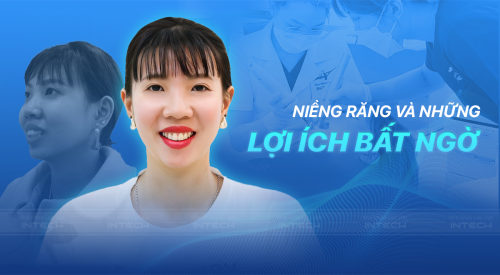 Niềng răng là gì? Tìm hiểu 7 tác dụng, lợi ích của việc đeo niềng