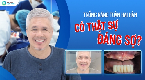 “LỰA CHỌN TRỒNG RĂNG IMPLANT TOÀN HAI HÀM - MỘT KẾT QUẢ ĐÁNG ĐỒNG TIỀN”  