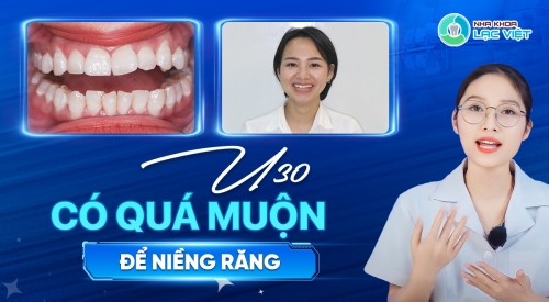 “U30 có quá muộn để niềng răng?”