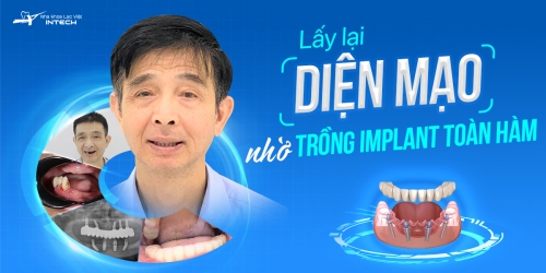 LẤY LẠI DIỆN MẠO NHỜ TRỒNG RĂNG IMPLANT