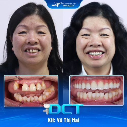 KH: Vũ Thị Mai