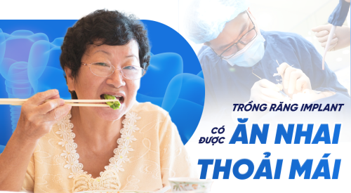 Trồng răng Implant xong có ăn nhai thoải mái không