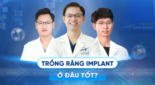 trồng răng implant ở đâu tốt