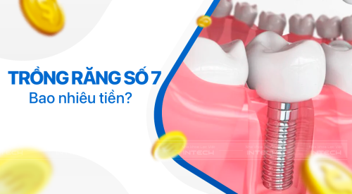 trồng răng số 7