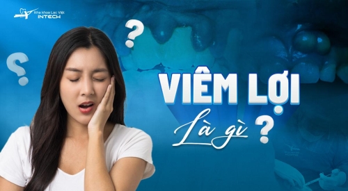 Viêm lợi là gì? Nguyên nhân, dấu hiệu và cách chữa trị viêm lợi hiệu quả