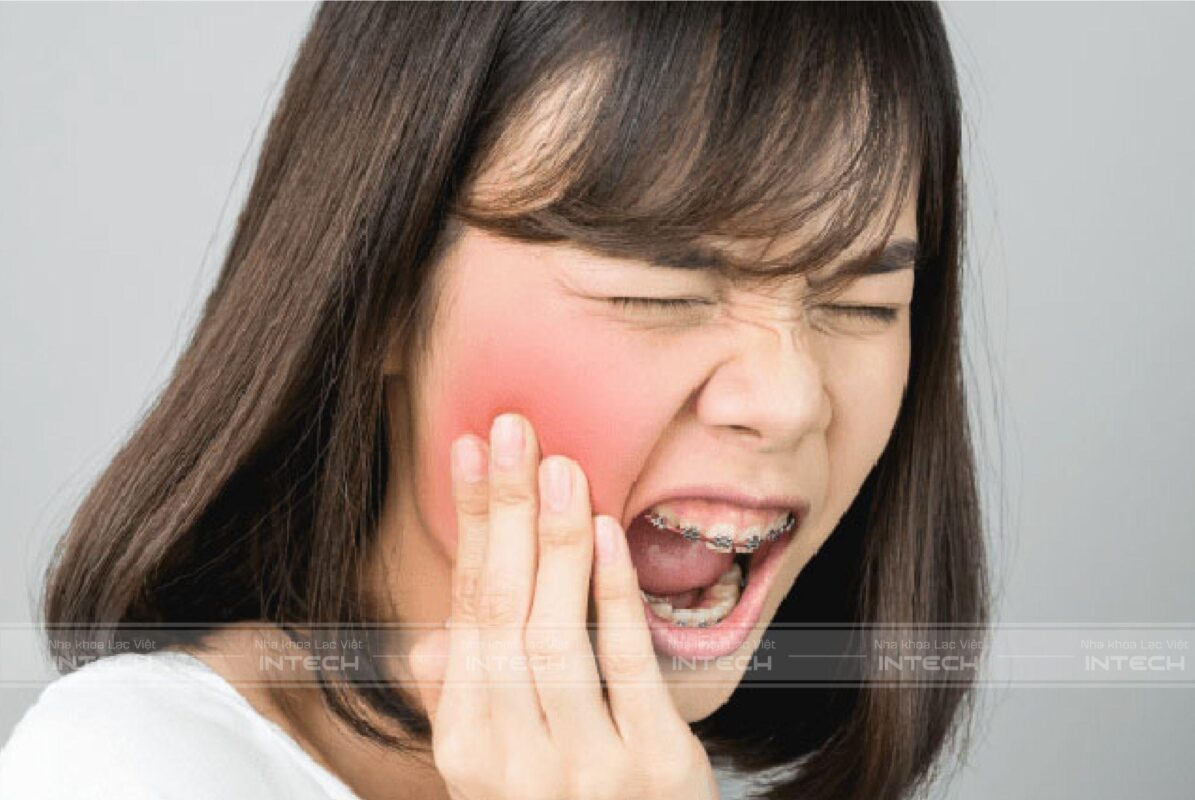 đau khi niềng răng hỏng