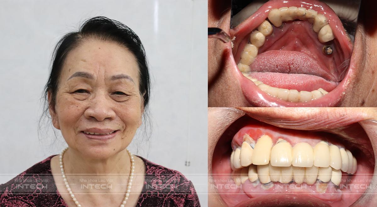 Tình trạng trước của khách hàng Nguyễn Thị Minh Phương