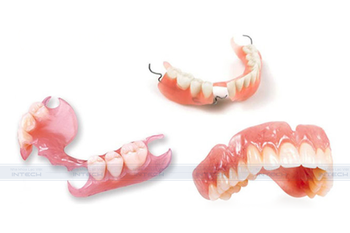Trồng răng giả bằng hàm tháo lắp
