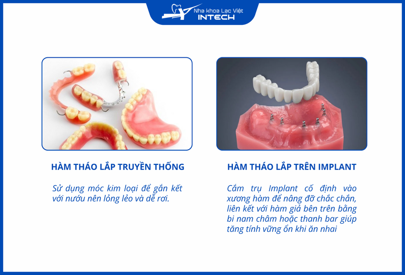 Hàm tháo lắp trên Implant là sự kết hợp giữa phương pháp hàm tháo lắp truyền thống và trồng Implant
