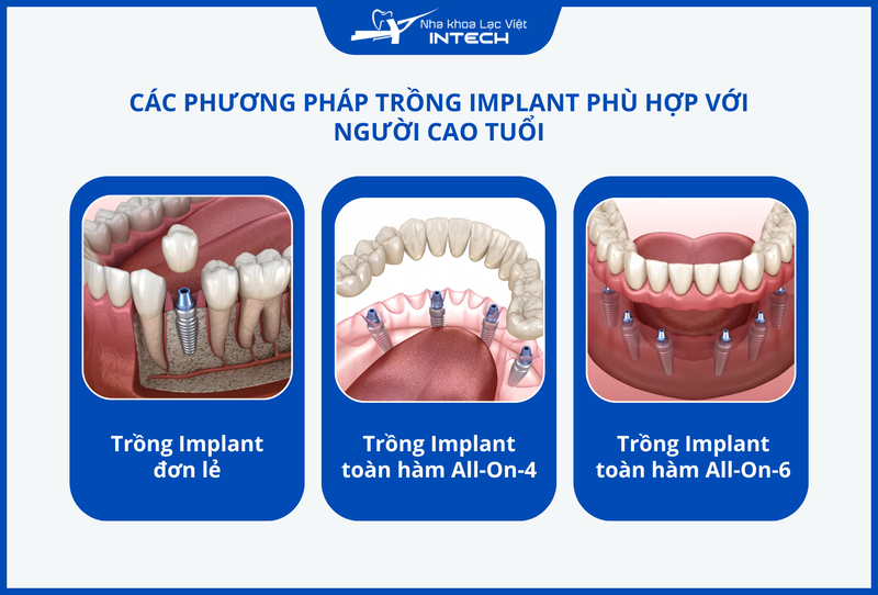 Người cao tuổi có thể chọn trồng Implant đơn lẻ, trồng toàn hàm All-On-4 hoặc All-On-6 tùy vào tình trạng mất răng của mình