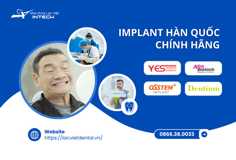 Implant Hàn Quốc là những dòng trụ vừa có chi phí hợp lý vừa đảm bảo chất lượng