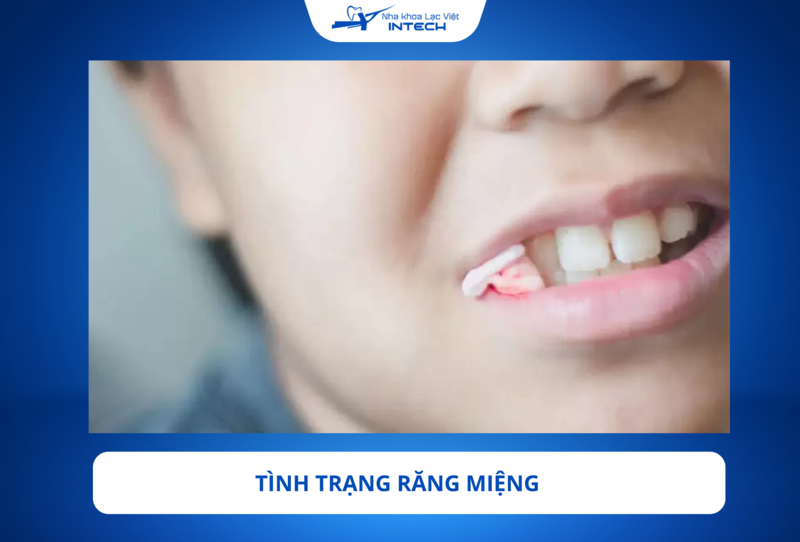 Các bệnh lý về răng miệng cần phải điều trị và chữa khỏi hoàn toàn trước khi tiến hành cấy ghép Implant