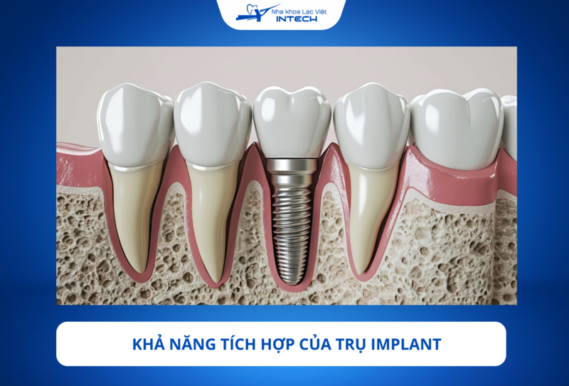 Mỗi loại trụ Implant có khả năng tích hợp khác nhau phụ thuộc vào công nghệ xử lý bề mặt