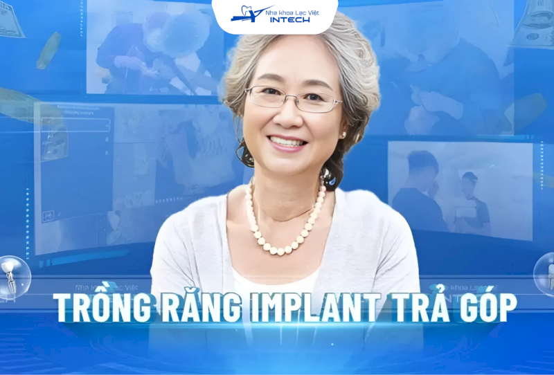 Chương trình trả góp khi trồng răng Implant được thiết kế tại Lạc Việt Intech