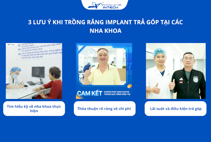 Cô chú/anh chị cần tìm hiểu kỹ về đội ngũ bác sĩ, đảm bảo họ có chuyên môn cao và giàu kinh nghiệm trong cấy ghép Implant