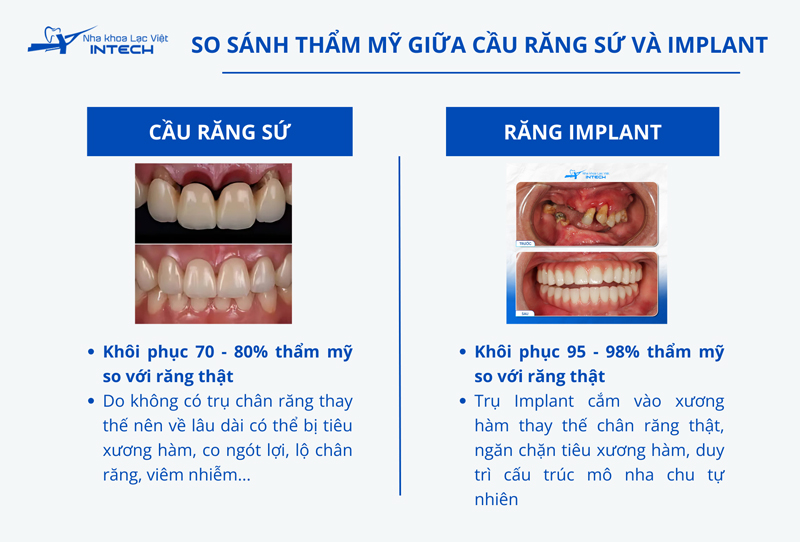 Về lâu dài, trồng răng Implant vẫn mang lại hiệu quả thẩm mỹ cao hơn vì bảo vệ được cấu trúc xương hàm và lợi