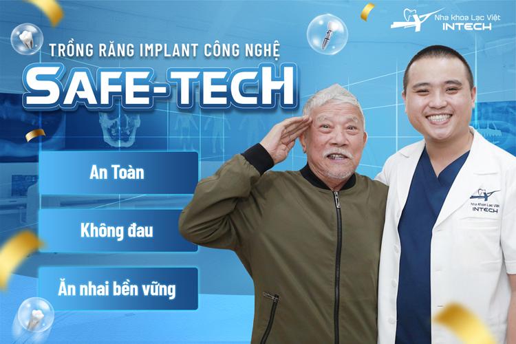 Công nghệ trồng răng Safe - tech - An toàn, không đau, ăn nhai bền vững