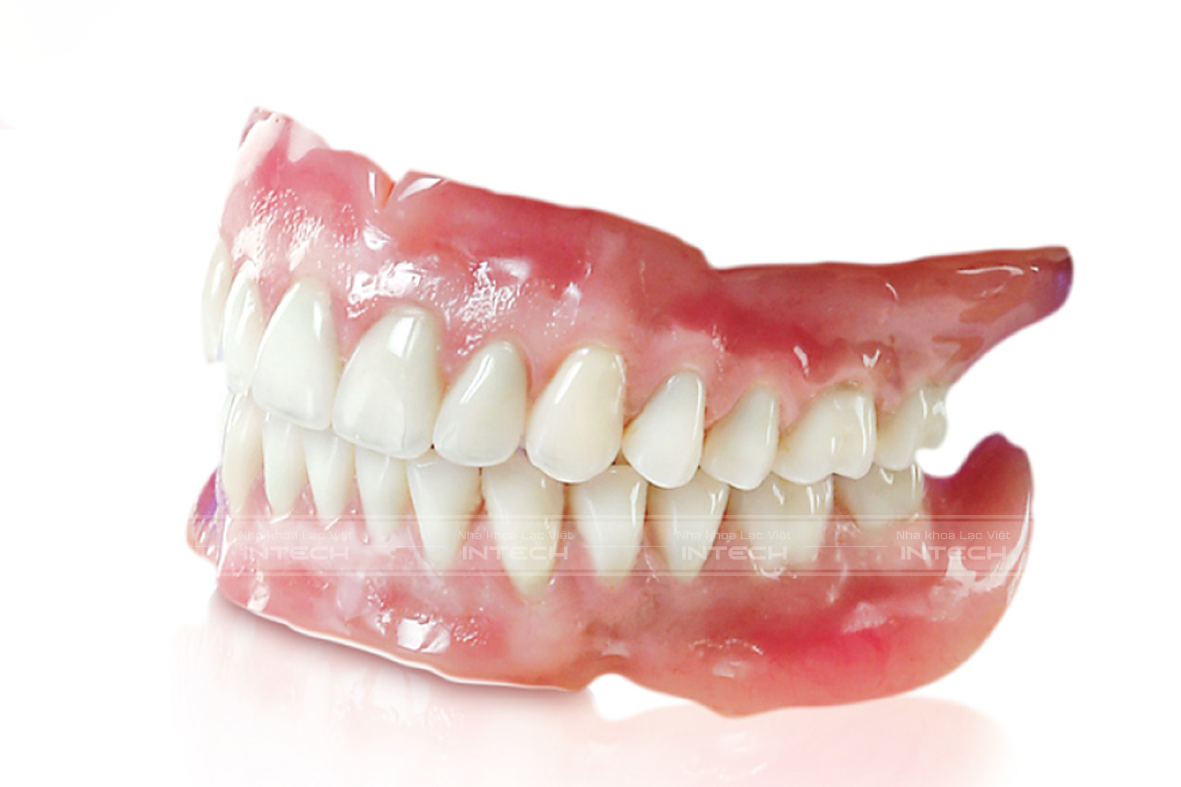 Trồng răng sứ bằng hàm giả tháo lắp