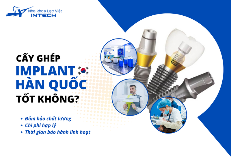 Implant Hàn Quốc là lựa chọn phù hợp cho những người có nhu cầu trồng Implant chất lượng mà vẫn tiết kiệm chi phí