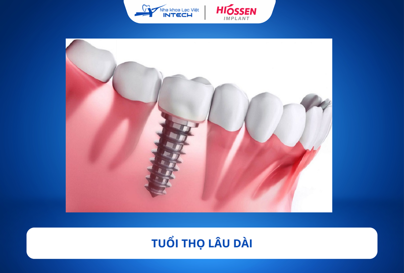  Khi răng Implant được cấy ghép đúng kỹ thuật và phục hình hoàn hảo, tuổi thọ của trụ có thể kéo dài ít nhất 20 năm