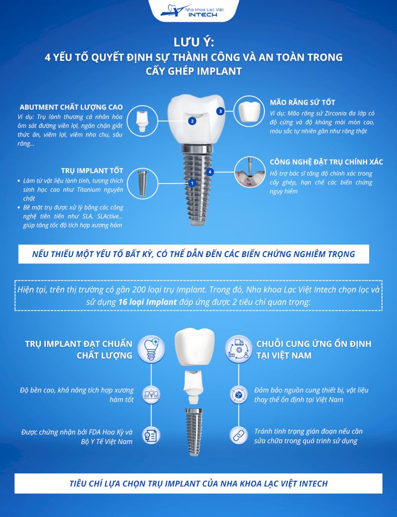 Những lưu ý khi lựa chọn trụ Implant theo tư vấn từ chuyên gia