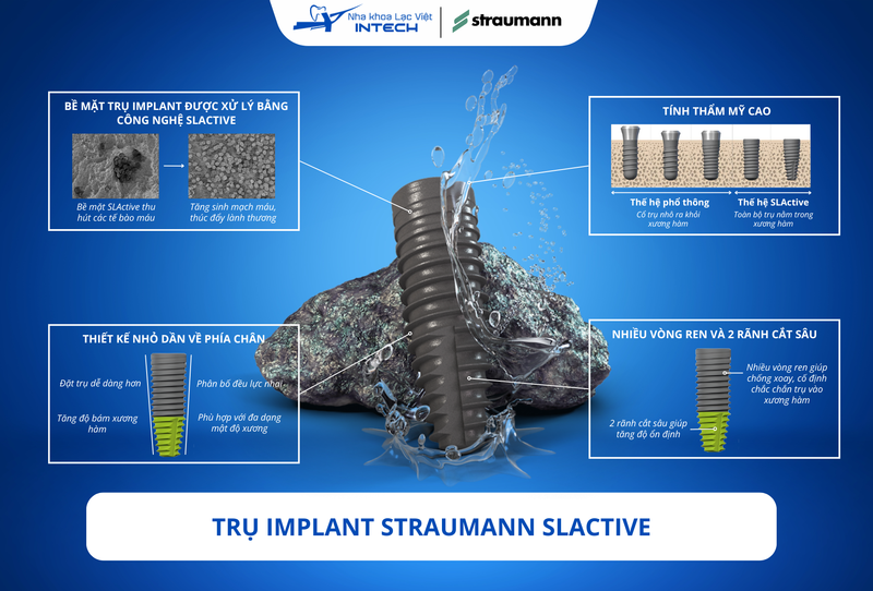 Thế hệ Implant Straumann thuộc phân khúc cao cấp nhất trên thị trường với chất lượng vượt trội