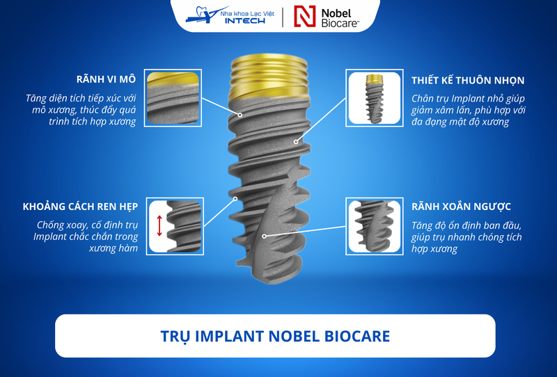 Trụ Nobel Biocare có thiết kế tiên tiến, tăng cường khả năng tích hợp mô mới sau cấy ghép