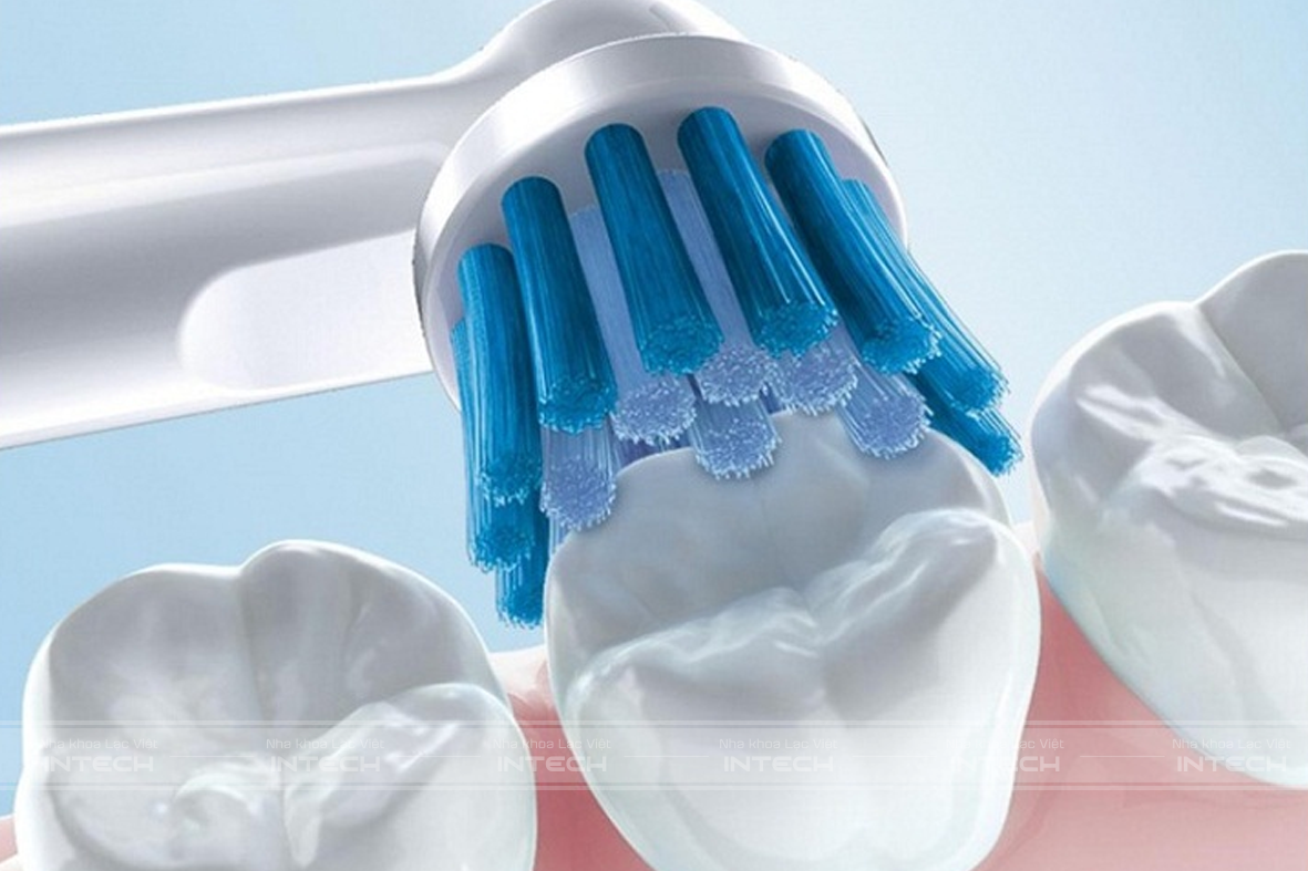 Vệ sinh răng miệng đúng cách
